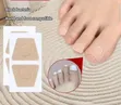 Toenail Fungus Patch Nail Repair Patches - 1