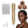 Electric Plasma Mole & Skin Tag Removal Pen - 1