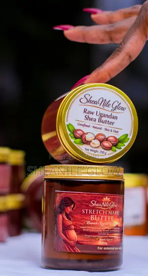 SheaNile Glow Siagi ya Mwili kwa Alama za Kunyoosha