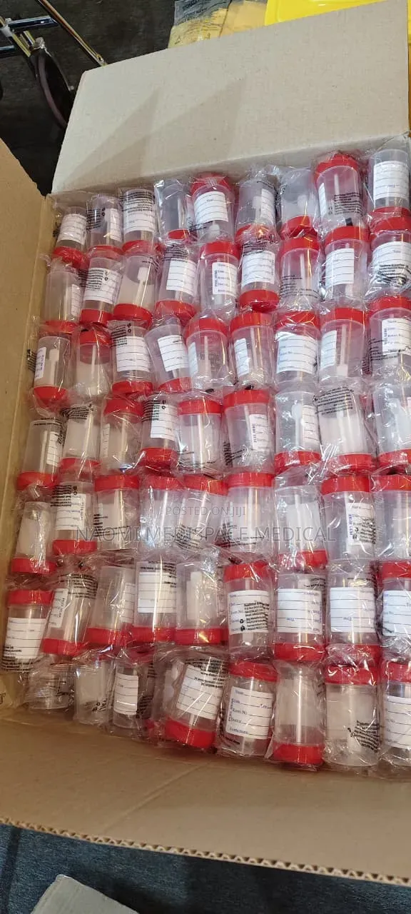 Urine Containers for Laboratory - 100 pcs - 1