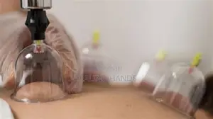 Hijama Therapy - Professional Home Visits
