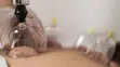 Hijama Therapy - Professional Home Visits - 1