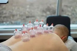 Hijama Therapy - Professional Home Visits
