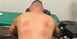 Hijama Therapy - Professional Home Visits - 4