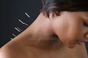 Professional Acupuncture Home Visits