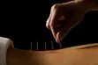 Professional Acupuncture Home Visits - 3