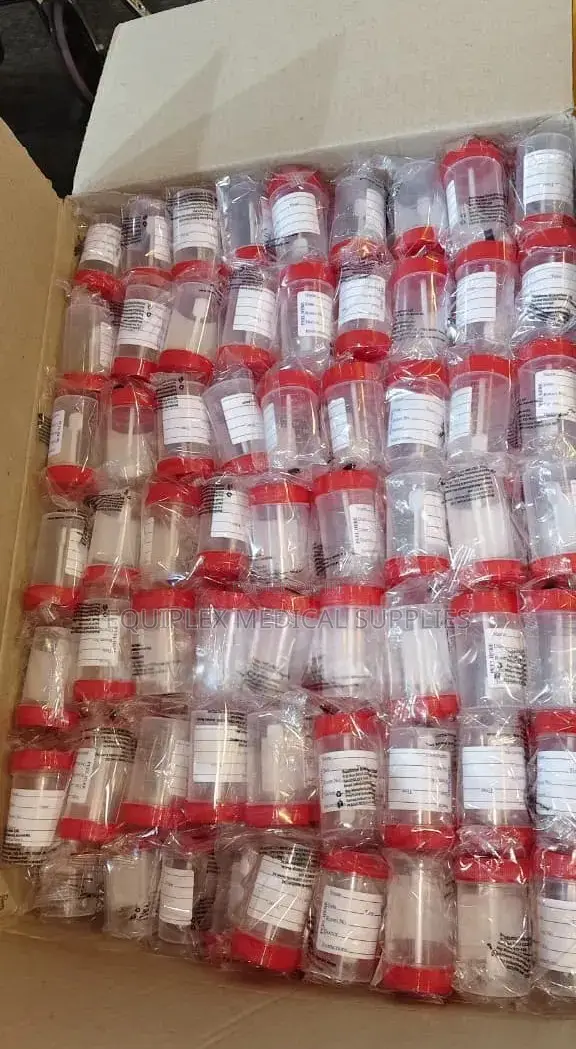 Urine Containers for Laboratory Use (100 Pieces) - 1