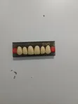 Artificial Denture Teeth - 1