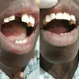 Professional Dental Services - Teeth Replacement, Braces & Fillings - 2