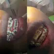 Professional Dental Services - Teeth Replacement, Braces & Fillings - 3