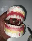 Professional Dental Services - Teeth Replacement, Braces & Fillings - 5