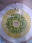 Colostomy Bags for Homecare Use - 2