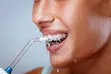 4 Nozzles Portable Oral Irrigator - USB Rechargeable - 2